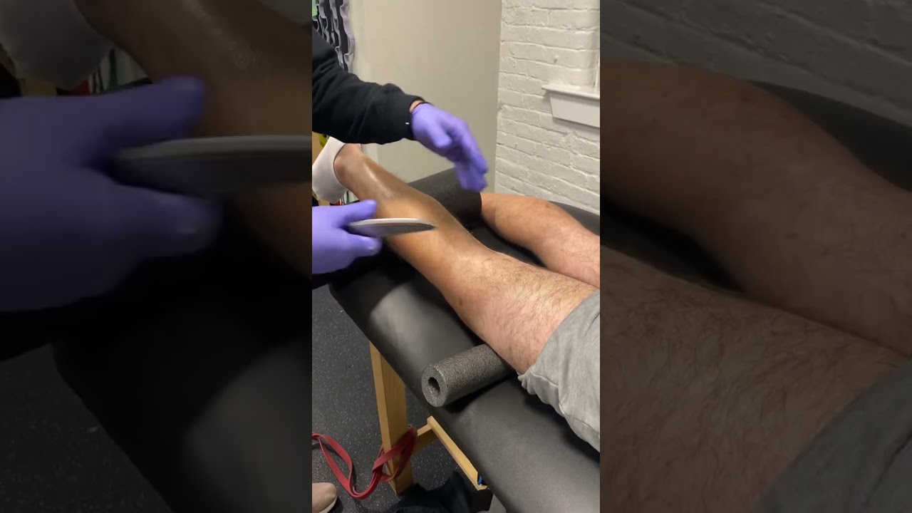 Physical therapy with soft tissue on ACL surgery 4 weeks post op