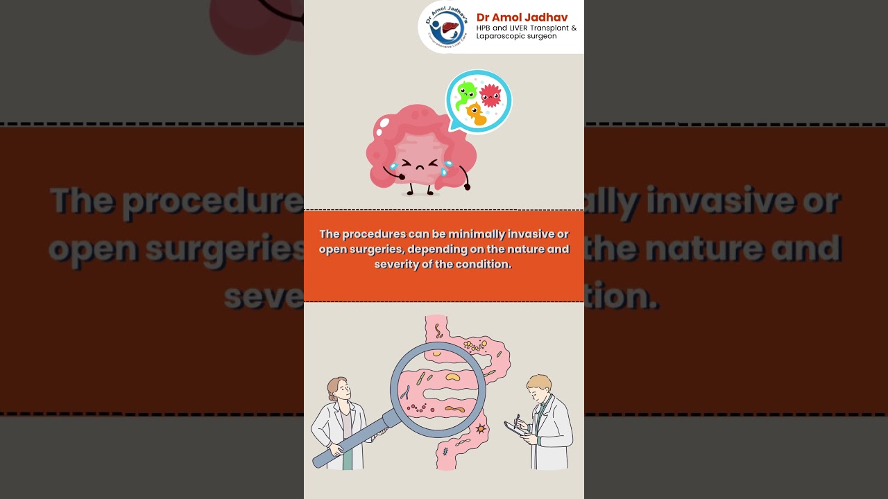 Gastrointestinal Surgery | Dr. Amol Jadhav | Best Liver Surgeon in Pune