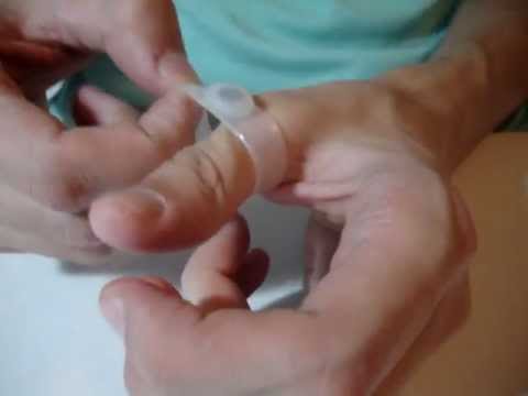 Kung paano mangayayat sa 3 araw gamit baking soda Xls medikal na pagbaba ng gabay ng timbang