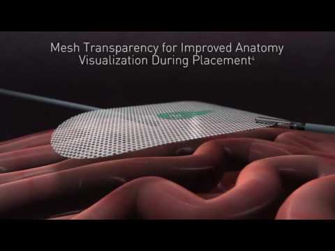 Symbotex™ Composite Mesh For Ventral Hernia Repair Animation