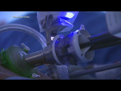 New robotic procedure showing promise for prostrate cancer