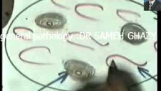 general pathology 11 : amyloid2 mucoid and myxomatous deg. DR SAMEH GHAZY