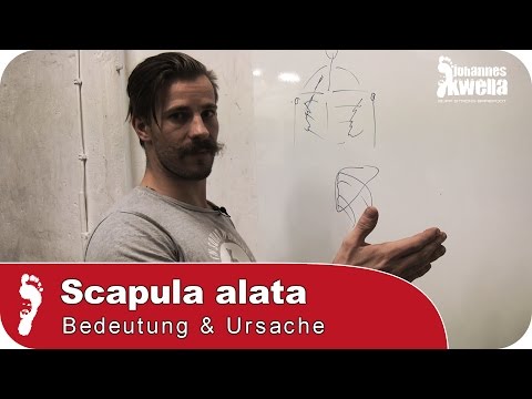 Scapula Alata (Engelsflügel) | Warum ihr sie unbedingt wegtrainieren solltet!