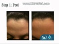 Face Care For Men Part 1