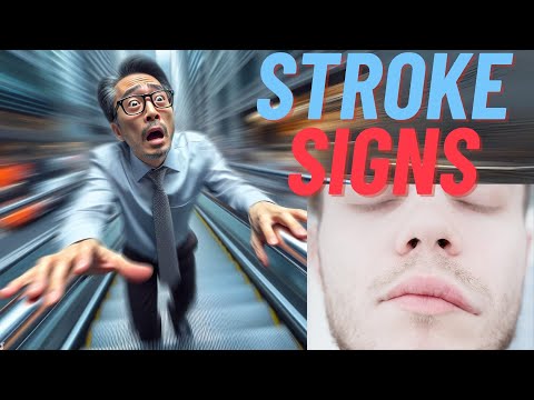Quickly Recognize Stroke: the Warning Signs and Taking Quick Action