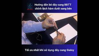 Thực hành chỉnh nha: Hướng dẫn bẻ dây cung BĐTT chỉnh lệch hàm dưới sang bên