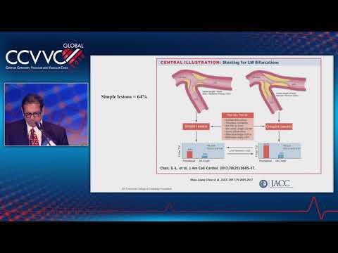 LM Bifurcation PCI: Two Stents in Majority