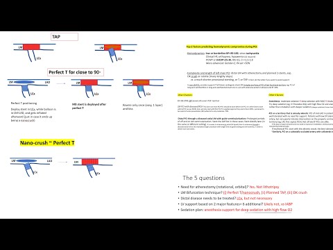 LV support in complex PCI- Left main stenting and bifurcation techniques - Elias Hanna