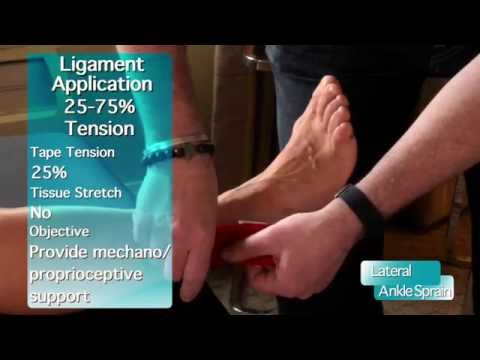 hogyan kell kezelni a boka sprain kenőcsöt