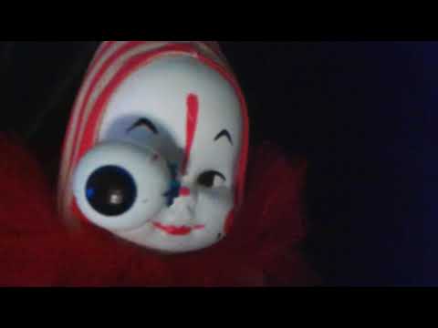 EYE POPPED OUT OF SOCKET