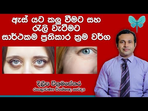 ඇස් යට කලු වීමට සහ රැලි වැටීමට සාර්ථකම ප්‍රතිකාර ක්‍රම - Under Eye Darkness and Uder Eye Wrinkles