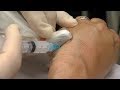 Mayo Clinic Minute: Is your thumb pain de Quervain's tenosynovitis?
