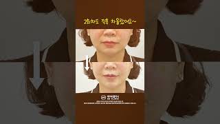 쥬베룩볼륨 3회차 효과