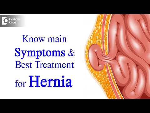 Was ist ein Leistenbruch? Symptome, Ursachen, Arten, Behandlung - Dr. Harish N S | Ärztekreis