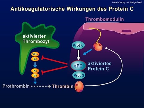 Lungenembolie aus hämostaseologischer Sicht | Charité | PD Dr. med. Jürgen Koscielny