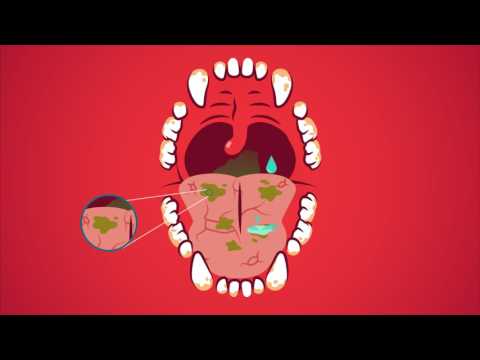 Oratene Maintenance Oral Gel (2.5 oz) Video