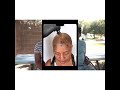Erma Alopecia SMP Testimonial Hair Transplants Are Scary Wigs Are Hot