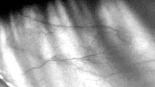 Casino Versus Japan - Sun Bee