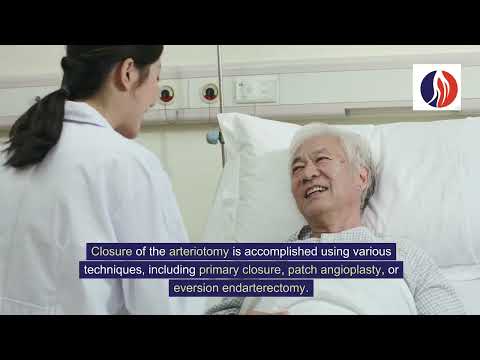 Carotid Endarterectomy