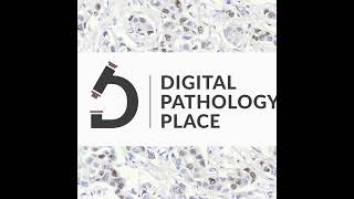 89: Navigating Ethical Challenges in AI-Powered Pathology | Webinar recording