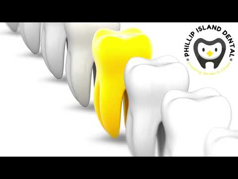 Phillip Island Dentist open 6 days