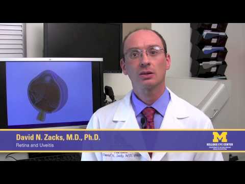 What is a detached retina and what are the causes?