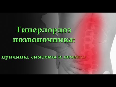 Шейный лордоз уплощен что это Лечить кифоз позвоночника