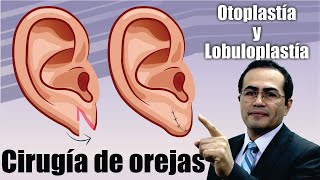 Otoplastia y lobuloplastía 👂🏼 Tipos de CIRUGÍA de OREJAS ❤️ Dr PERCY NEVADO Cirugía Plástica
