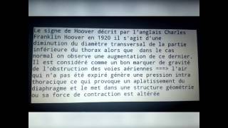 Signe de Hoover médecine Hoover sign