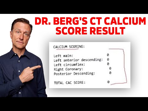 Dr.Berg's Reaction on his CT Calcium Scoring Test Result