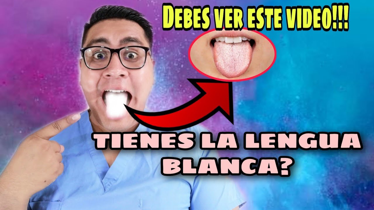 LENGUA SABURRAL/LENGUA BLANCA-POR QUE SALE Y COMO TRATARLA