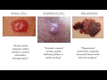 Dermatology on USMLE/COMLEX