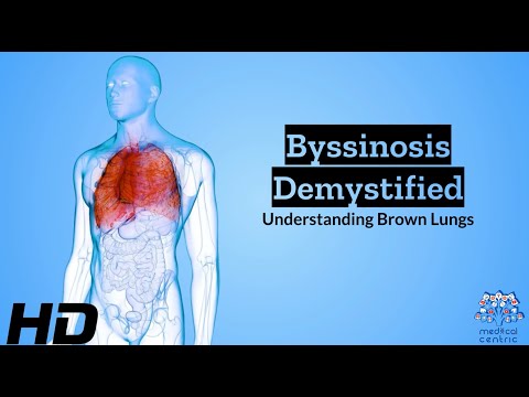 Nasal and Paranasal Tumors Causes Signs and Symptoms Diagnosis and Treatment