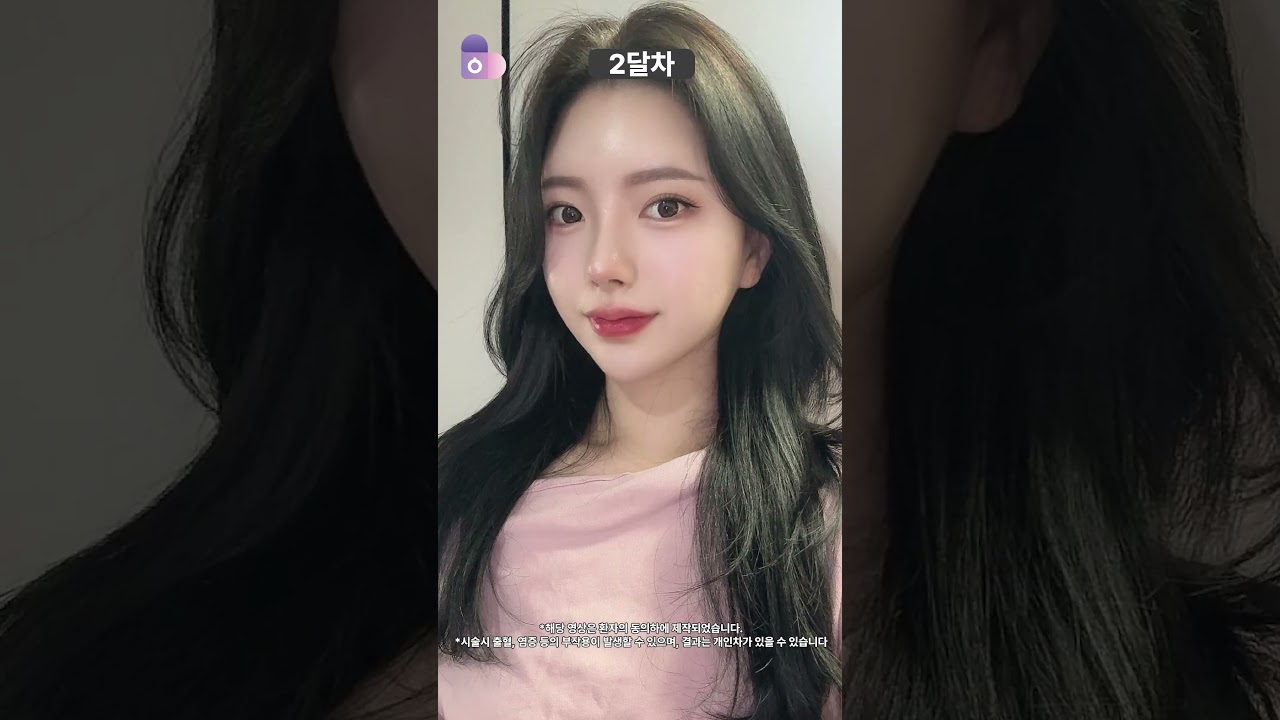 찍을수록 차이 나는 '옆태' 라인