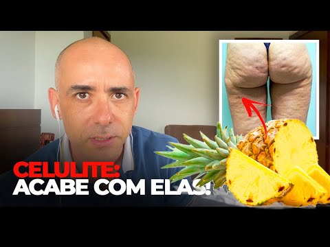 , title : 'COMO DIMINUIR SUAS CELULITES EM 15 DIAS, E EM CASA!  | Dr Dayan Siebra'