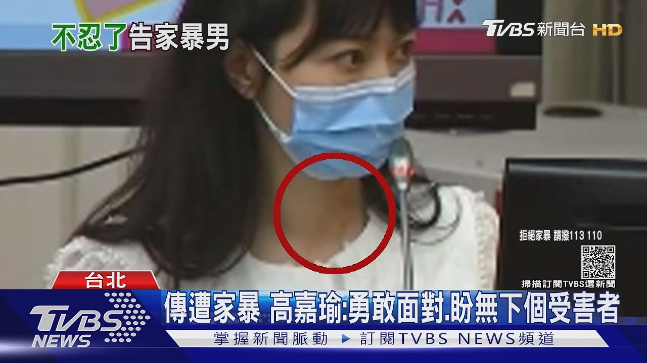 不忍了!傳遭男友暴打成傷 高嘉瑜提告傷害