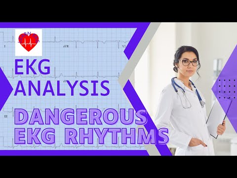 5 Dangerous and Lethal EKG Rhythms