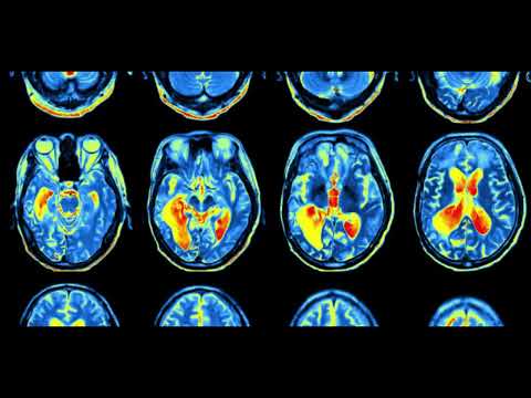 BOg, Ben C, Mental Order, Dan Schultz, Baremind, Eleonora  / ADHD  (DEHB) -  DJ Audioventurer Mix