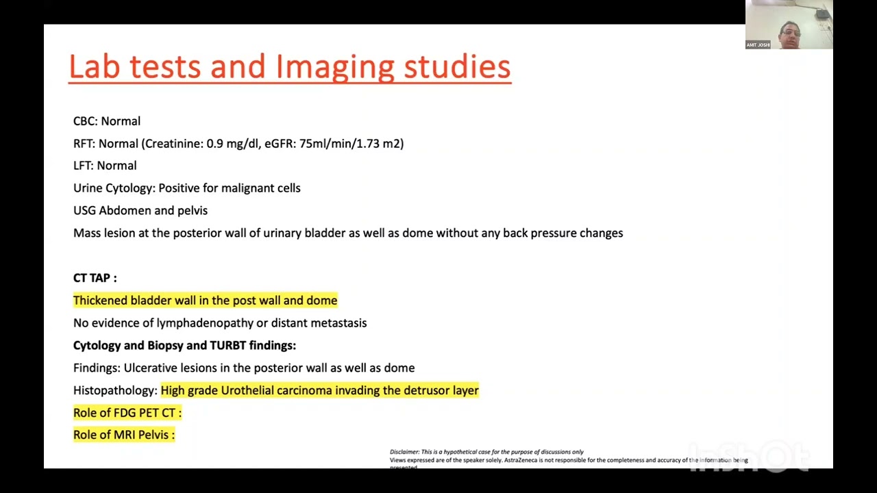 NIAGARA Insights: Perioperative Strategies in Urothelial Carcinoma