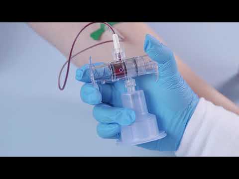 Steripath Gen2 Blood Culture Collection By Magnolia Medical Technologies