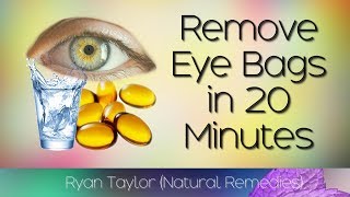 How To Remove Eye Bags (20 Minute Natural Remedies)