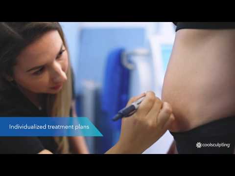 about coolsculpting
