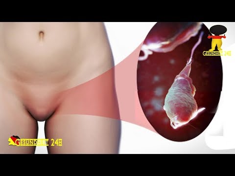 Vorbereitung zur Entfernung von Prostata-Entzündung Prostatamassage Fisting