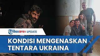 Kondisi Mengenaskan Tentara Ukraina yang Dibebaskan Rusia, Tangan Bengkok dan Tulang Hilang 4 Cm