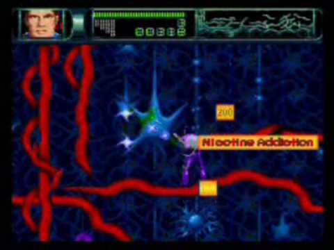 FG´s Underrated Videogame Music 108 - The Brain (Rex Ronan: Experimental Surgeon)