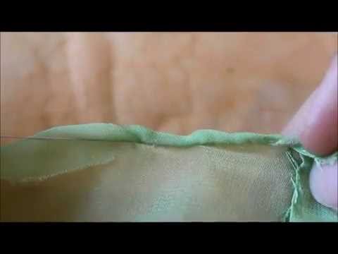 Pulizia laser di posti di pigmentary I posti di pigmentary hanno apparito da dietro di abbronzatura