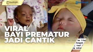 Viral Transformasinya Bayi Lahir Prematur dengan Tubuh Kecil & Kulit Gelap Jadi Cantik
