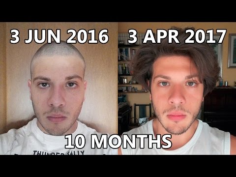 Top Hair Growth Time Lapse - 10 Months