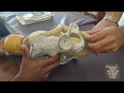 Pinard's method of complicated breech delivery | Obstetrics| medicine