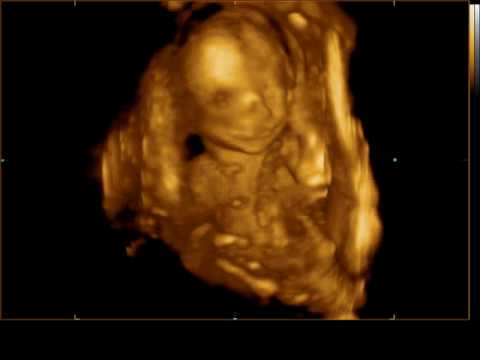 ecografia de nuestro bebe Isai Gonzalez y Selmy Quintal